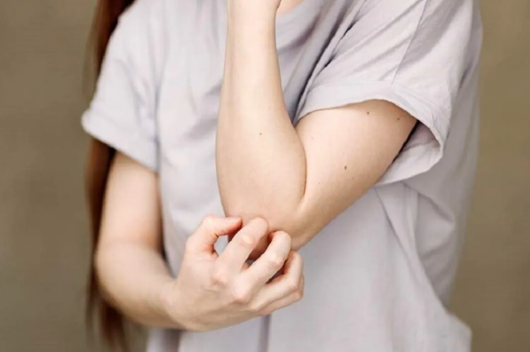 عادات وأمراض مرتبطة بجفاف الجلد