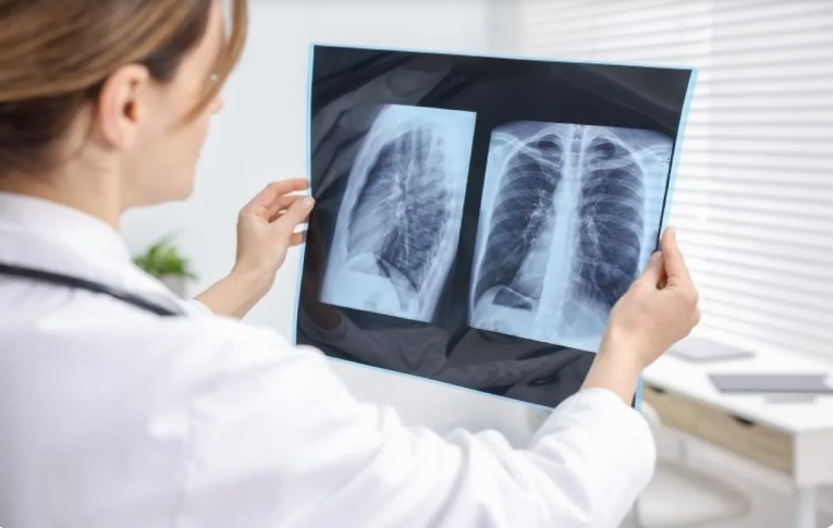 لماذا تتأثر النساء بأمراض الرئة أكثر من الرجال؟